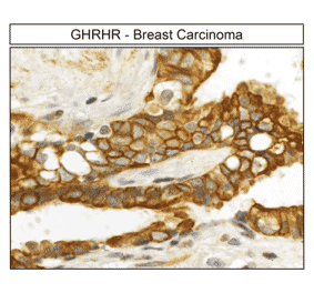 Immunohistochemistry - Anti-GHRHR Antibody (A334478) - Antibodies.com