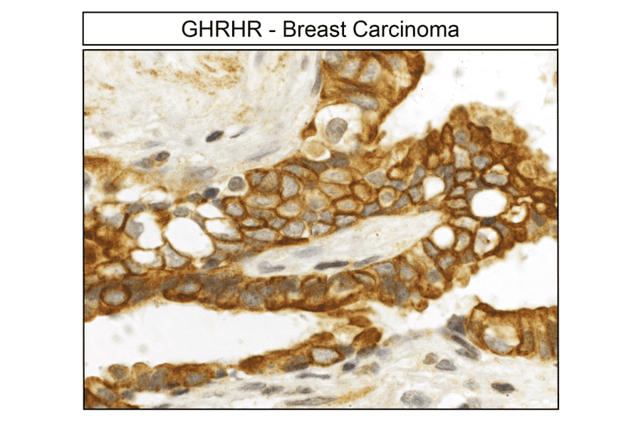 Immunohistochemistry - Anti-GHRHR Antibody (A334478) - Antibodies.com