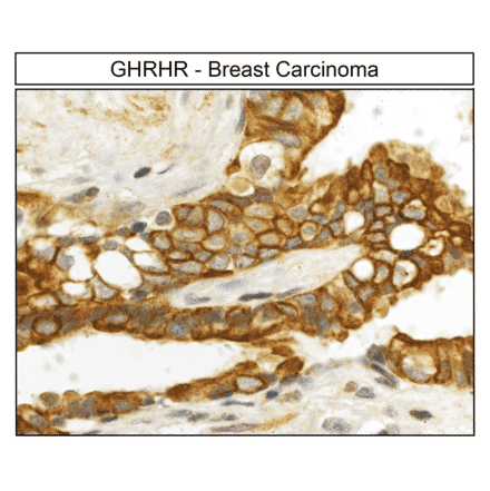 Immunohistochemistry - Anti-GHRHR Antibody (A334478) - Antibodies.com