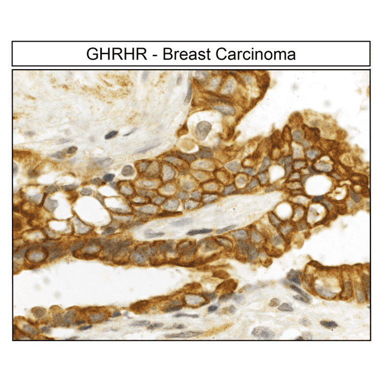 Immunohistochemistry - Anti-GHRHR Antibody (A334478) - Antibodies.com