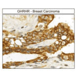 Immunohistochemistry - Anti-GHRHR Antibody (A334478) - Antibodies.com