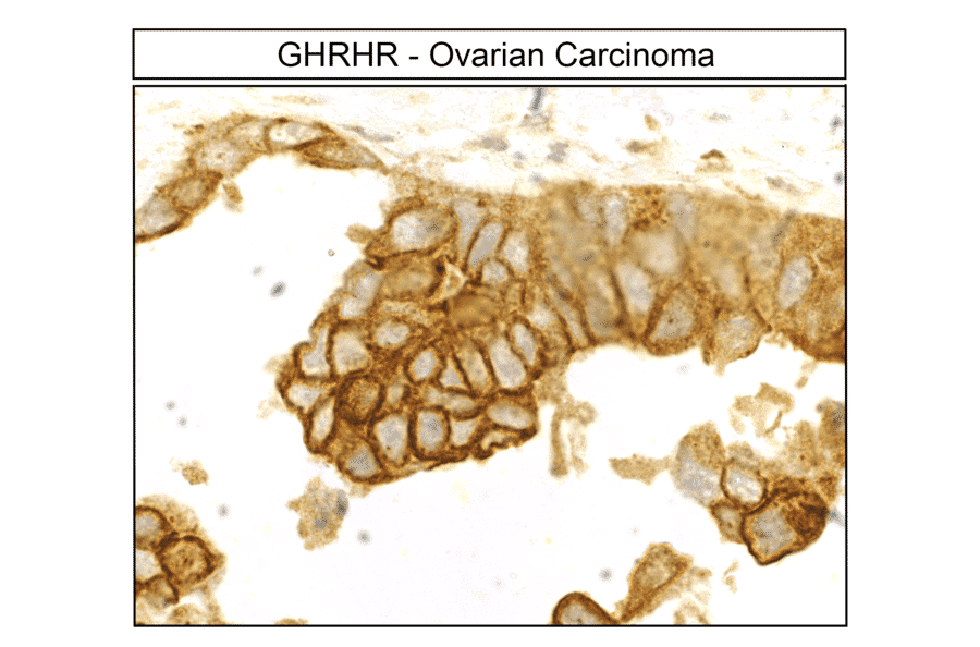 Immunohistochemistry - Anti-GHRHR Antibody (A334478) - Antibodies.com