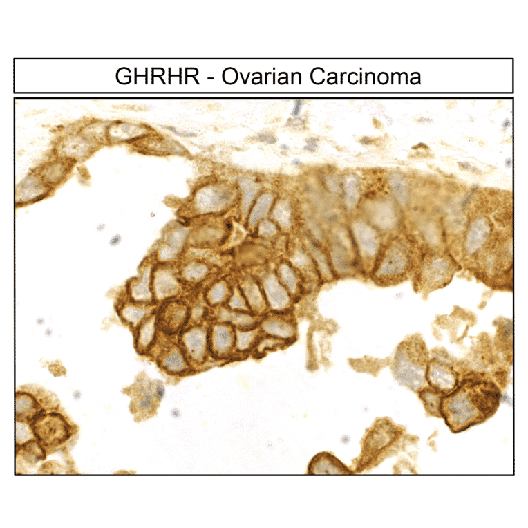 Immunohistochemistry - Anti-GHRHR Antibody (A334478) - Antibodies.com