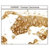 Immunohistochemistry - Anti-GHRHR Antibody (A334478) - Antibodies.com