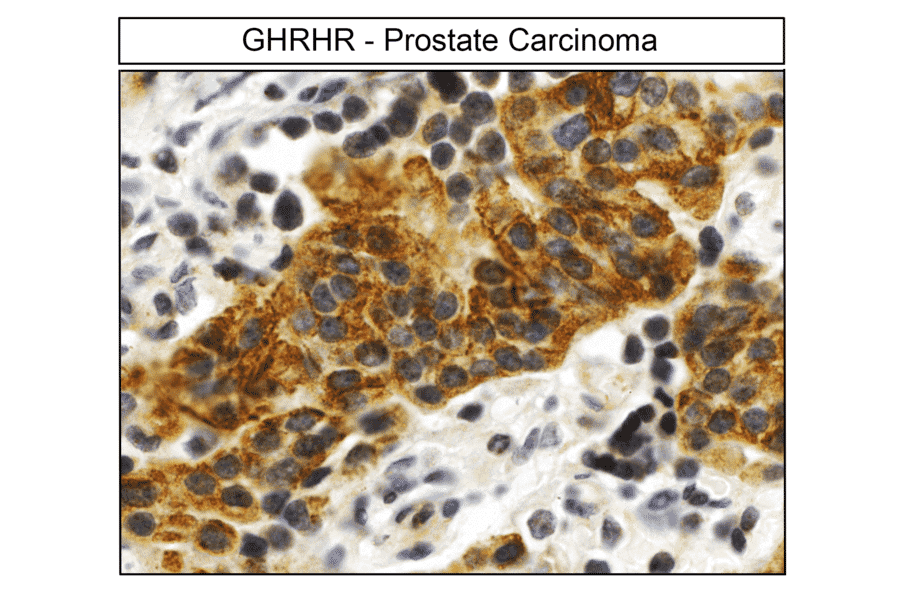 Immunohistochemistry - Anti-GHRHR Antibody (A334478) - Antibodies.com