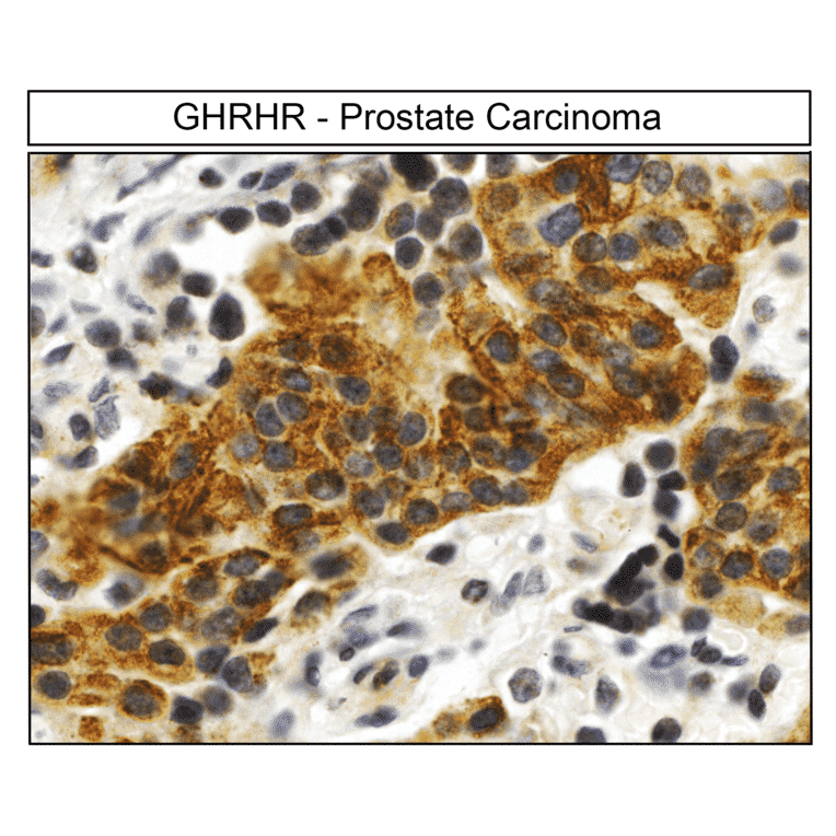 Immunohistochemistry - Anti-GHRHR Antibody (A334478) - Antibodies.com