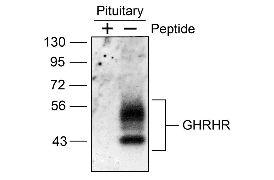 Western blot - Anti-GHRHR Antibody (A334478) - Antibodies.com