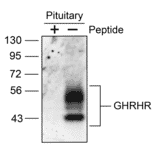 Western blot - Anti-GHRHR Antibody (A334478) - Antibodies.com