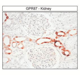 Immunohistochemistry - Anti-GPCR GPR87 Antibody (A334479) - Antibodies.com