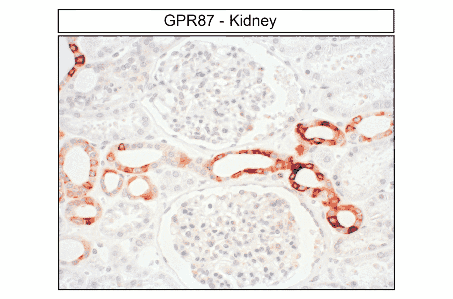 Immunohistochemistry - Anti-GPCR GPR87 Antibody (A334479) - Antibodies.com