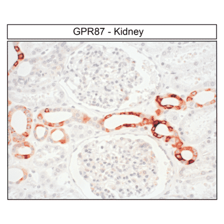 Immunohistochemistry - Anti-GPCR GPR87 Antibody (A334479) - Antibodies.com