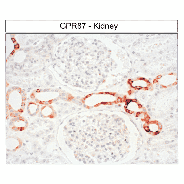 Immunohistochemistry - Anti-GPCR GPR87 Antibody (A334479) - Antibodies.com