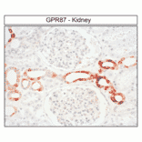 Immunohistochemistry - Anti-GPCR GPR87 Antibody (A334479) - Antibodies.com