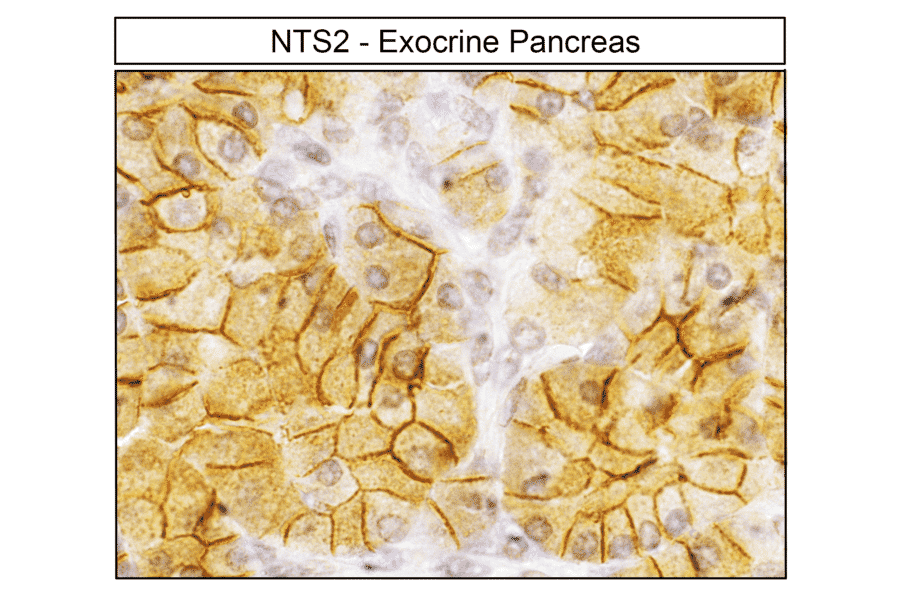 Immunohistochemistry - Anti-Neurotensin Receptor 2 Antibody (A334480) - Antibodies.com