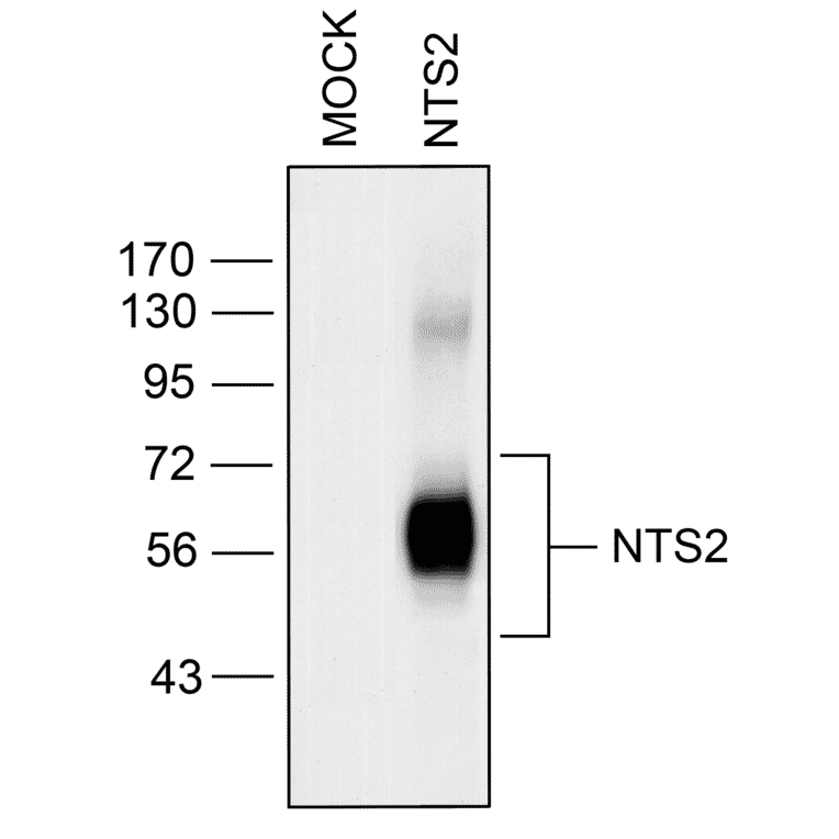 Western blot - Anti-Neurotensin Receptor 2 Antibody (A334480) - Antibodies.com