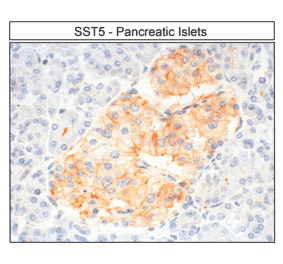 Immunohistochemistry - Anti-SSTR5 Antibody (A334481) - Antibodies.com