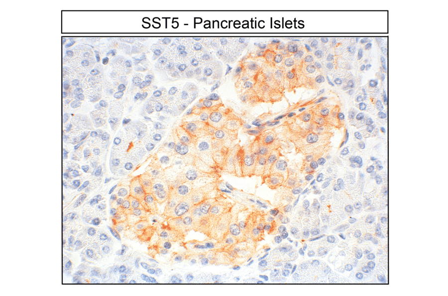 Immunohistochemistry - Anti-SSTR5 Antibody (A334481) - Antibodies.com