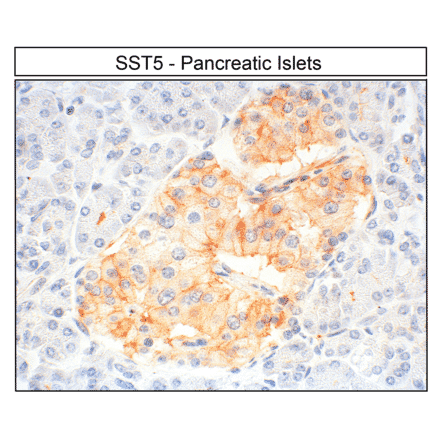 Immunohistochemistry - Anti-SSTR5 Antibody (A334481) - Antibodies.com