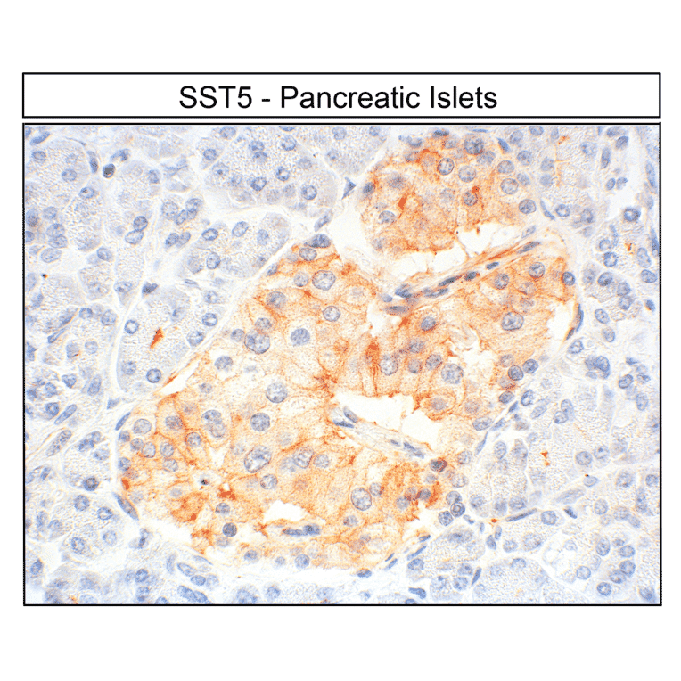 Immunohistochemistry - Anti-SSTR5 Antibody (A334481) - Antibodies.com