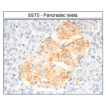 Immunohistochemistry - Anti-SSTR5 Antibody (A334481) - Antibodies.com