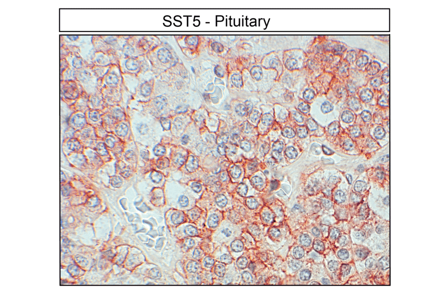 Immunohistochemistry - Anti-SSTR5 Antibody (A334481) - Antibodies.com