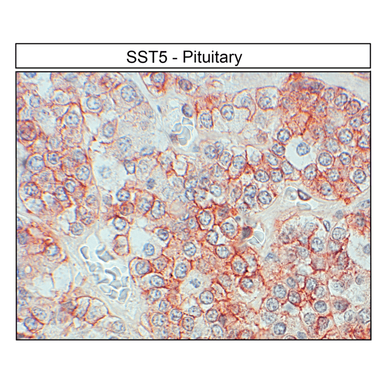 Immunohistochemistry - Anti-SSTR5 Antibody (A334481) - Antibodies.com