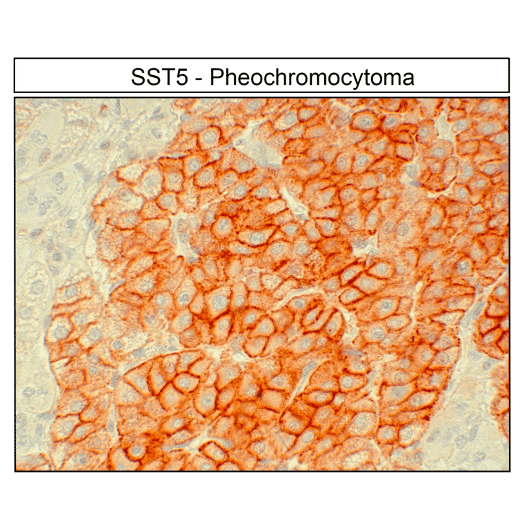 Immunohistochemistry - Anti-SSTR5 Antibody (A334481) - Antibodies.com