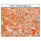 Immunohistochemistry - Anti-SSTR5 Antibody (A334481) - Antibodies.com