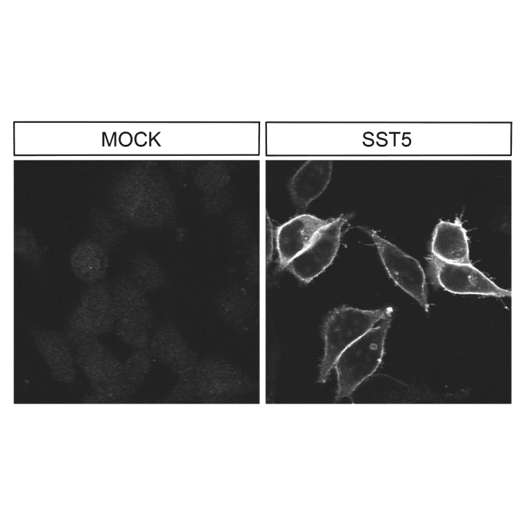Immunohistochemistry - Anti-SSTR5 Antibody (A334481) - Antibodies.com