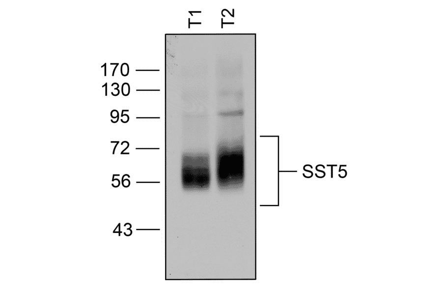 Western blot - Anti-SSTR5 Antibody (A334481) - Antibodies.com