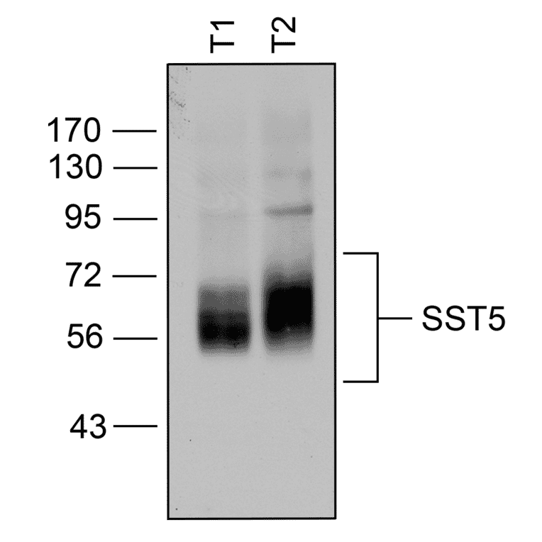 Western blot - Anti-SSTR5 Antibody (A334481) - Antibodies.com