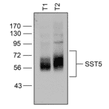 Western blot - Anti-SSTR5 Antibody (A334481) - Antibodies.com