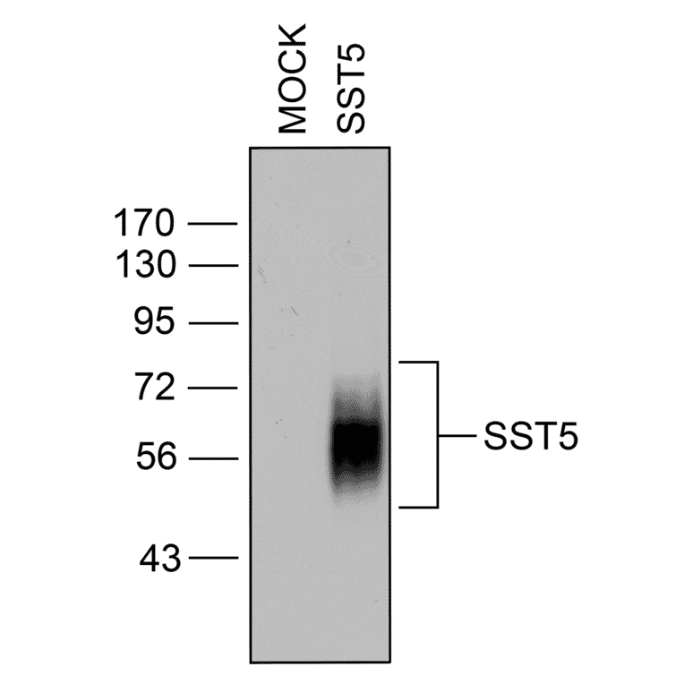 Western blot - Anti-SSTR5 Antibody (A334481) - Antibodies.com