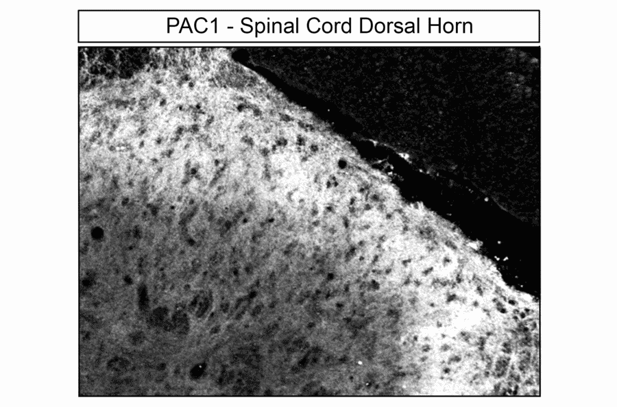 Immunohistochemistry - Anti-PAC1R Antibody (A334483) - Antibodies.com