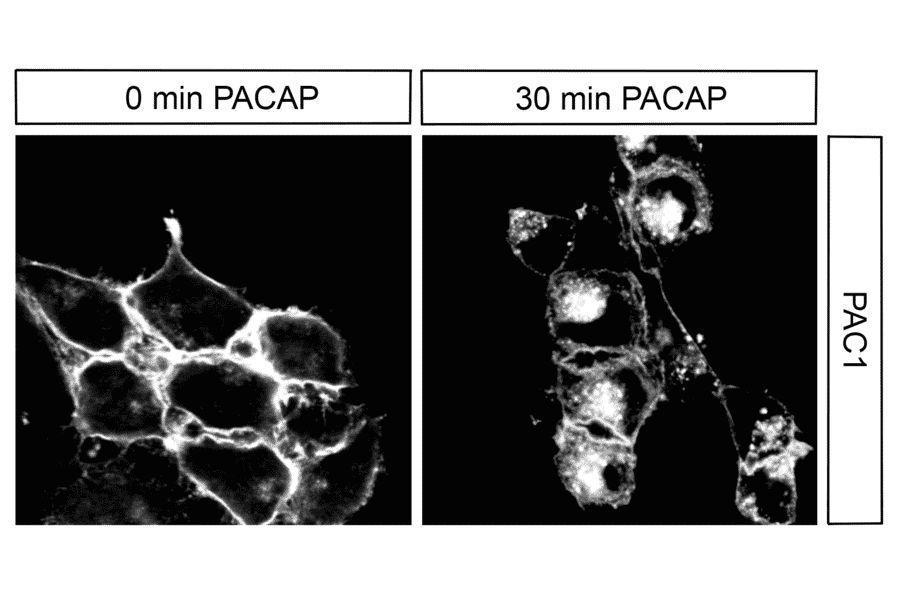 Immunohistochemistry - Anti-PAC1R Antibody (A334483) - Antibodies.com