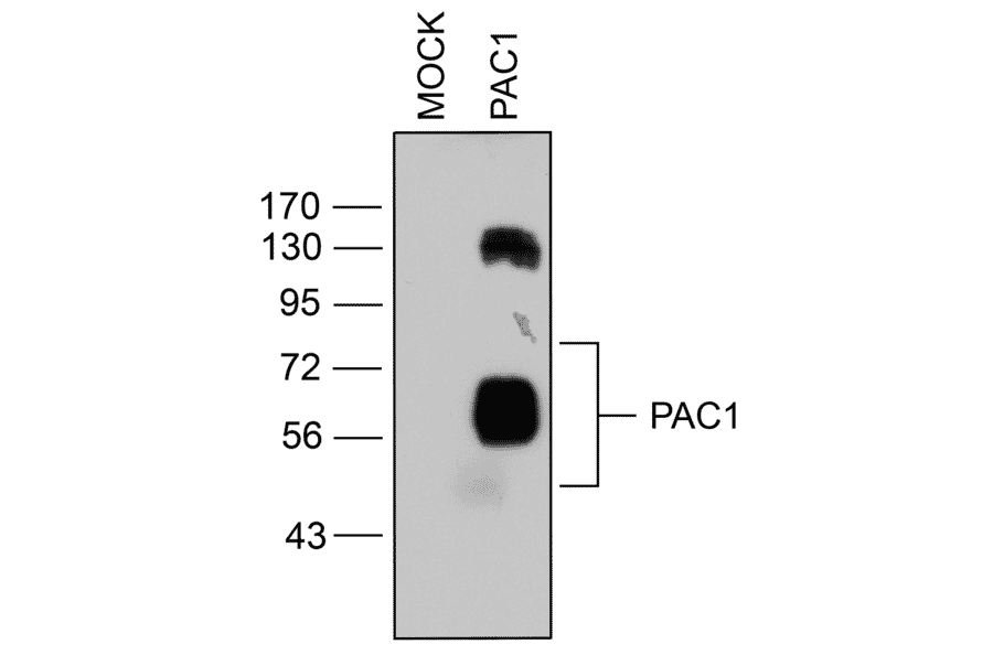 Western blot - Anti-PAC1R Antibody (A334483) - Antibodies.com