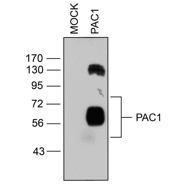Western blot - Anti-PAC1R Antibody (A334483) - Antibodies.com