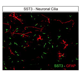 Immunohistochemistry - Anti-SSTR3 Antibody (A334484) - Antibodies.com