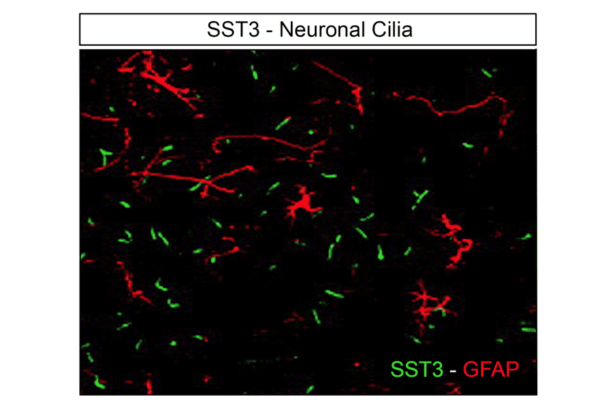 Immunohistochemistry - Anti-SSTR3 Antibody (A334484) - Antibodies.com