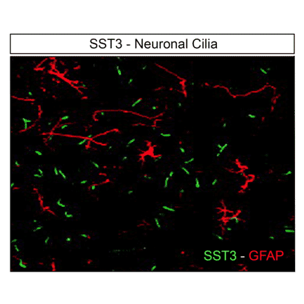 Immunohistochemistry - Anti-SSTR3 Antibody (A334484) - Antibodies.com