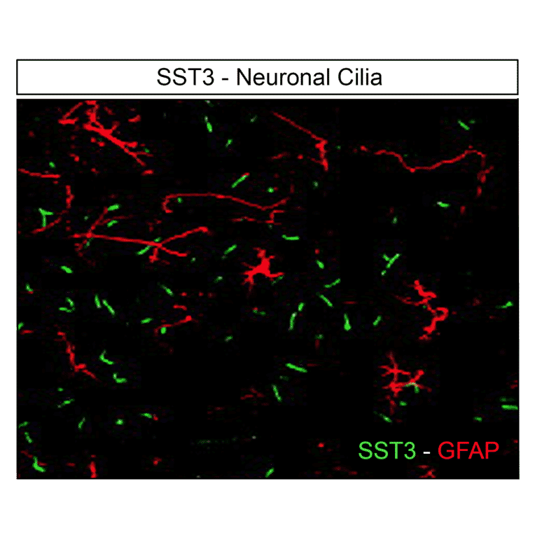 Immunohistochemistry - Anti-SSTR3 Antibody (A334484) - Antibodies.com