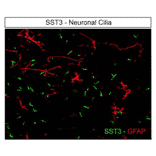 Immunohistochemistry - Anti-SSTR3 Antibody (A334484) - Antibodies.com