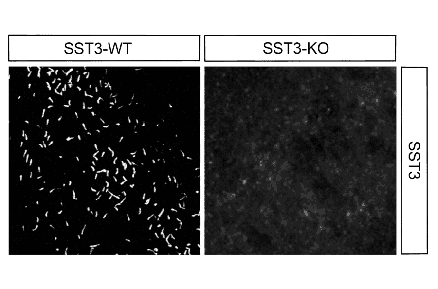 Immunohistochemistry - Anti-SSTR3 Antibody (A334484) - Antibodies.com