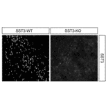 Immunohistochemistry - Anti-SSTR3 Antibody (A334484) - Antibodies.com