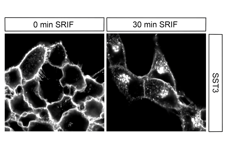 Immunohistochemistry - Anti-SSTR3 Antibody (A334484) - Antibodies.com