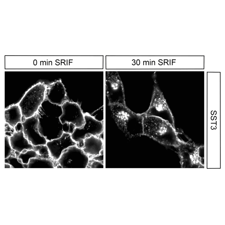Immunohistochemistry - Anti-SSTR3 Antibody (A334484) - Antibodies.com