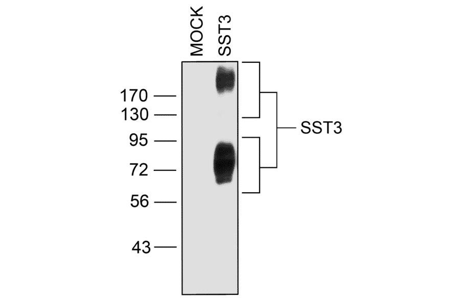 Western blot - Anti-SSTR3 Antibody (A334484) - Antibodies.com