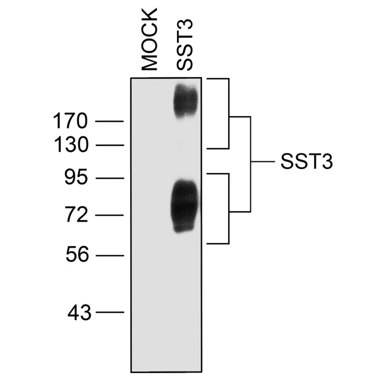 Western blot - Anti-SSTR3 Antibody (A334484) - Antibodies.com