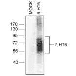 Western blot - Anti-5HT6 Receptor Antibody (A334487) - Antibodies.com