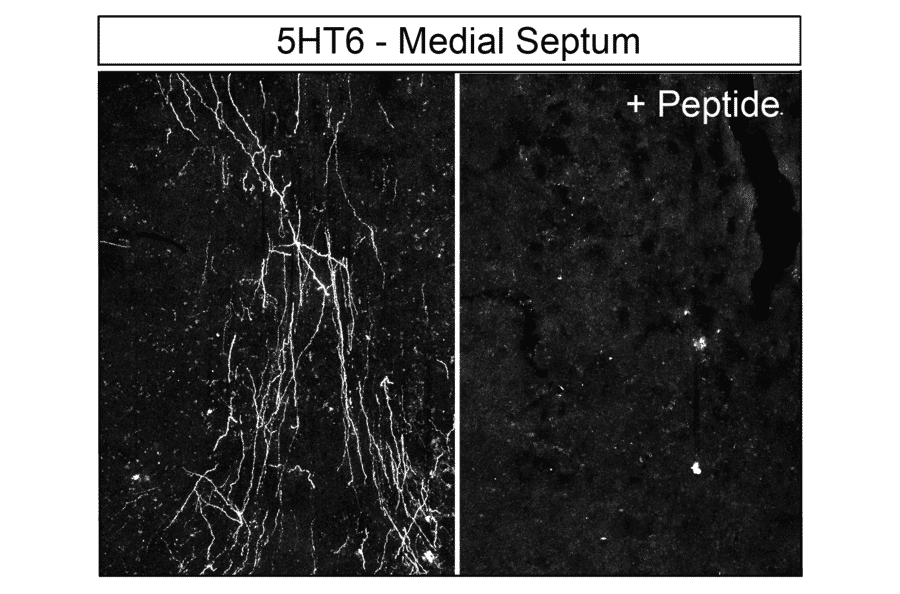 Immunohistochemistry - Anti-5HT6 Receptor Antibody (A334487) - Antibodies.com
